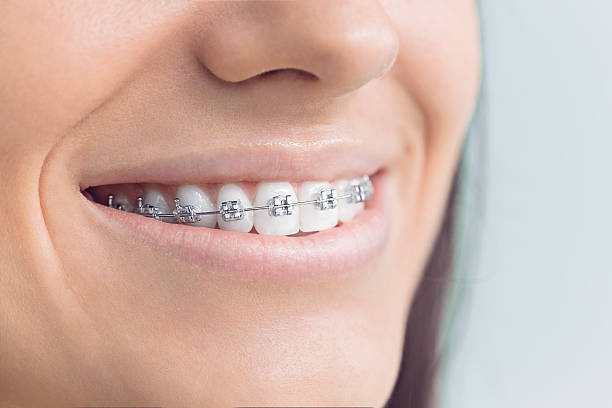 Trusted Laporte, CO  Holistic Dental Services Experts